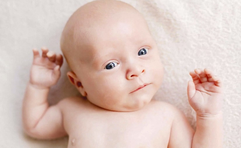 torcicolo congenito bebe
